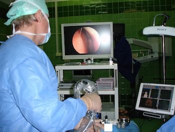 Operacja endoskopowa jam nosa i zatok